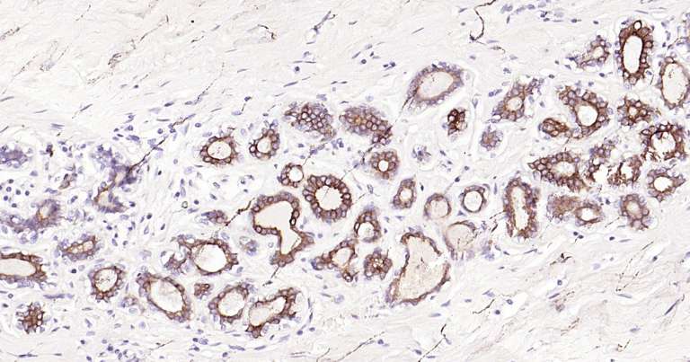 人细胞角蛋白18即用型免疫组化试剂盒-IHC0249H